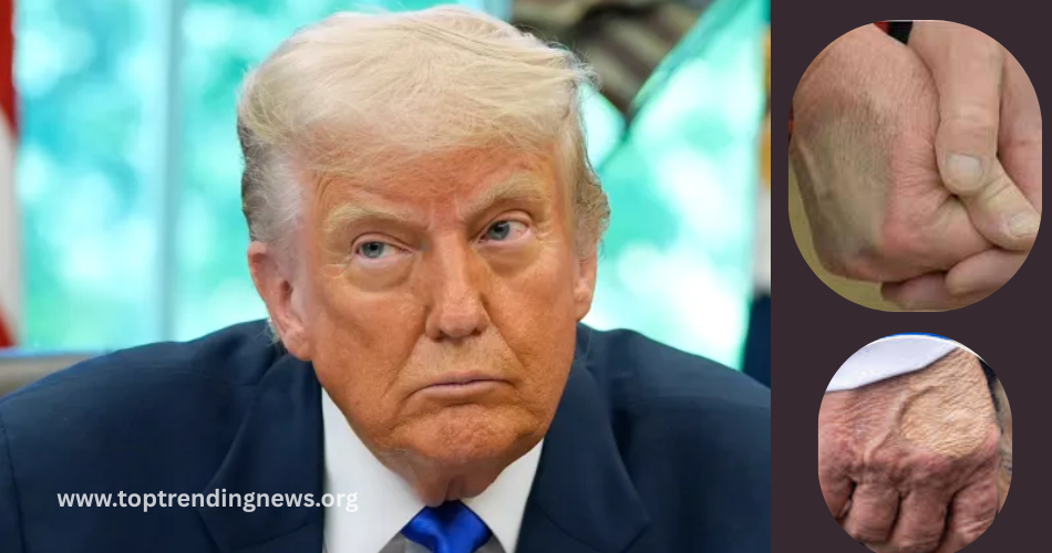 trump u